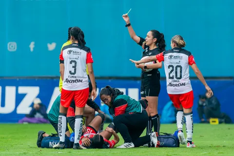 Así le quedó el pie a una jugadora del Atlas tras el partido contra Cruz Azul Femenil